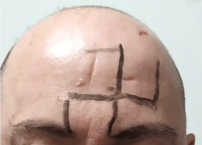 Homoseksuele man geslagen en krijgt swastika op voorhoofd getekend