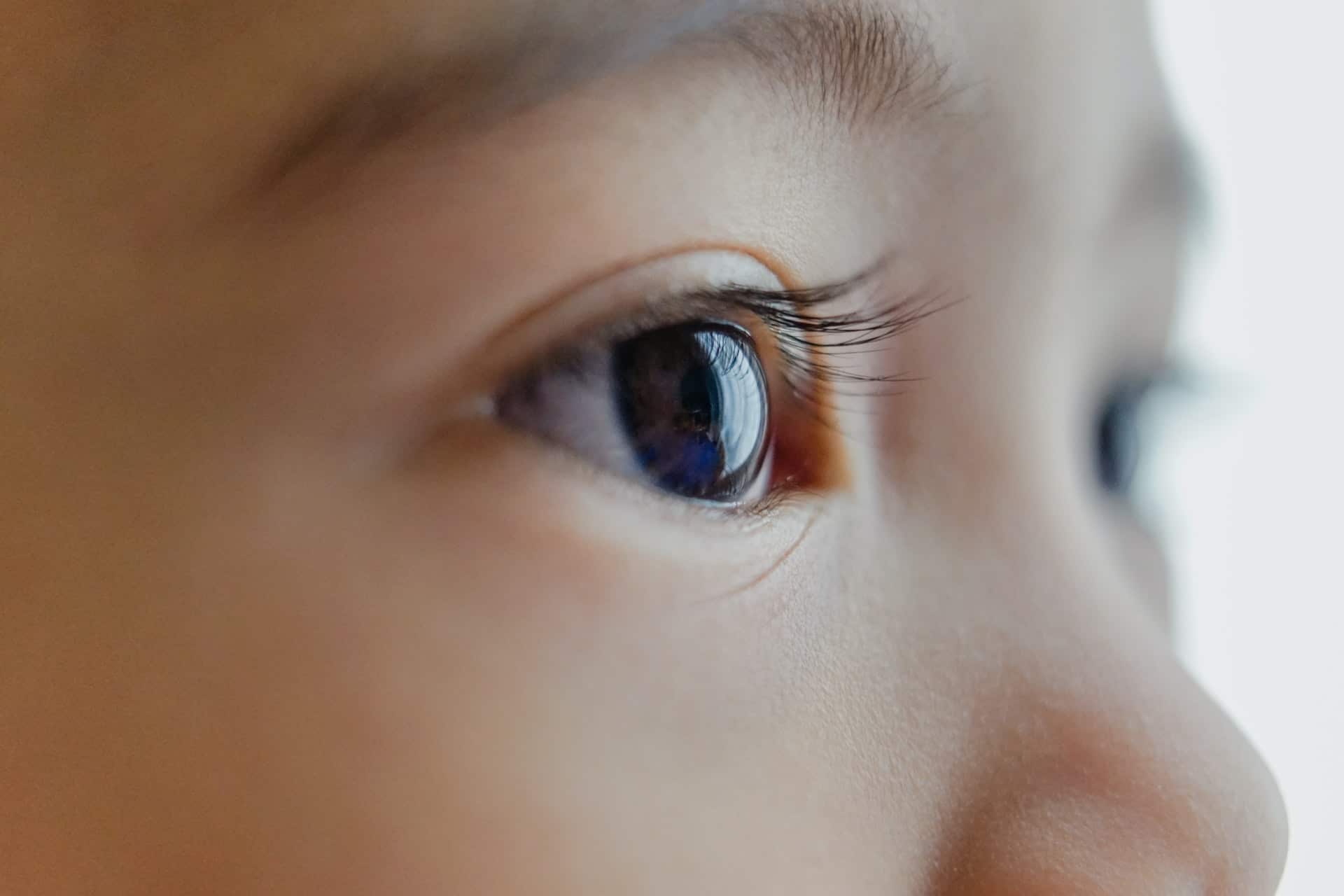 7 maanden oude scheelkijkende baby blijkt hersentumor te hebben, ouders dachten dat hij enkel een bril nodig had